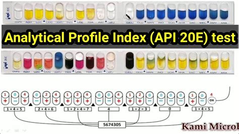 analytical profile index|API (Analytical Profile Index) 20E Test .